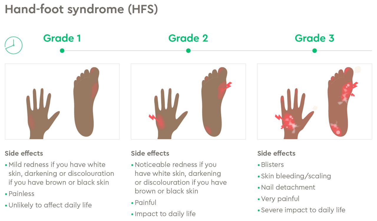HFS diagram